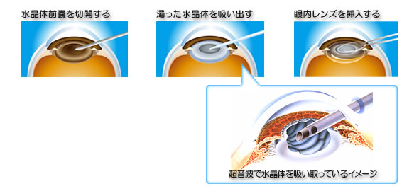 �������p�C���[�W�}