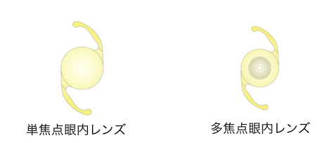 ���œ_�����Y�C���[�W�}